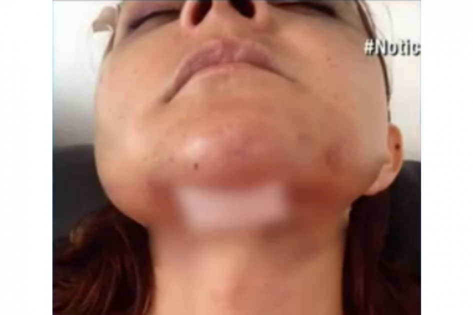 Aparece otra víctima de clínica estética clandestina en Bogotá