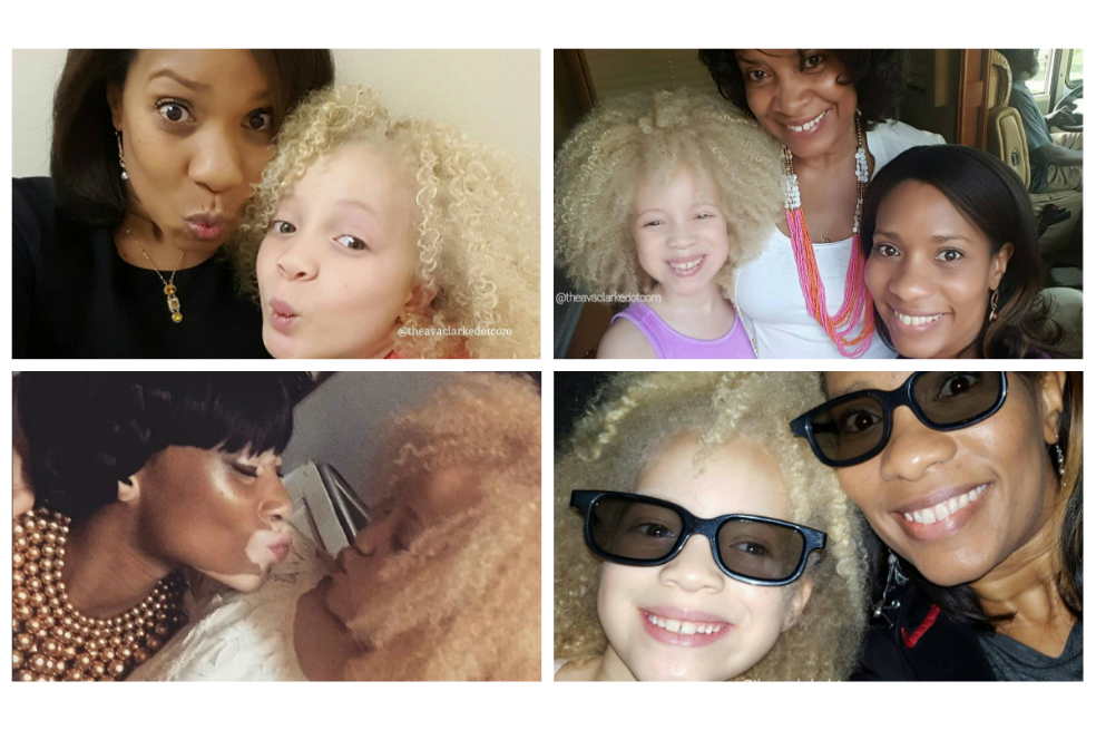 La niña albina e hija de padres afros que revoluciona las pasarelas del modelaje
