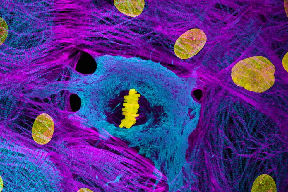 Dr. James Hayes ocupó el décimo puesto. En su foto se observan las células del músculo cardíaco (derivadas de iPSC) que muestran cromosomas condensados ​​en metafase.