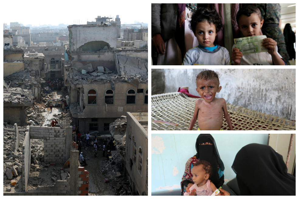 Yemen: año y medio entre la hambruna y la guerra