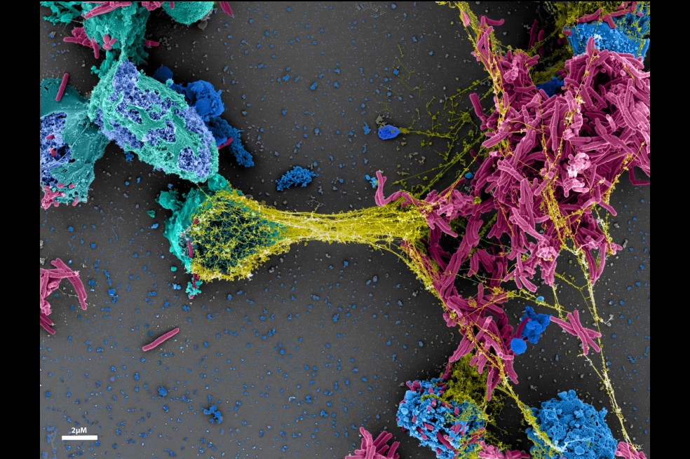 Chanchal Sur Chowdhury llamó a su imagen "Spiderman de nuestro cuerpo". Consiste mostrar cómo las células inmunes se comunican entre sí para proteger nuestro cuerpo de la invasión de partículas extrañas o microorganismos.