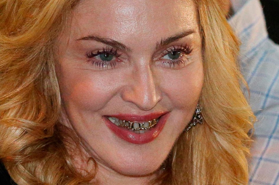 Madonna sorprende con sus dientes de oro