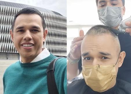 “Es un problema menos”, Diego Guauque se rapó después de su primera quimioterapia