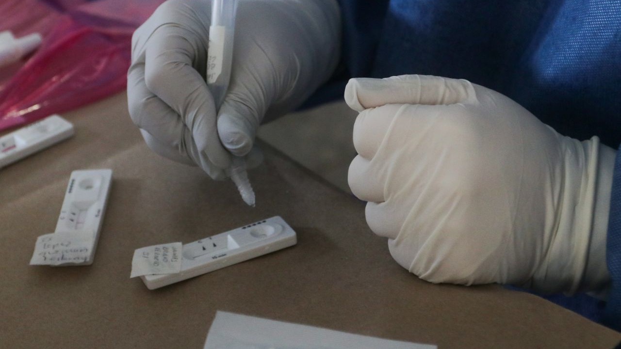 Coronavirus: Así Son Los Test De Anticuerpos De Venta En Farmacias