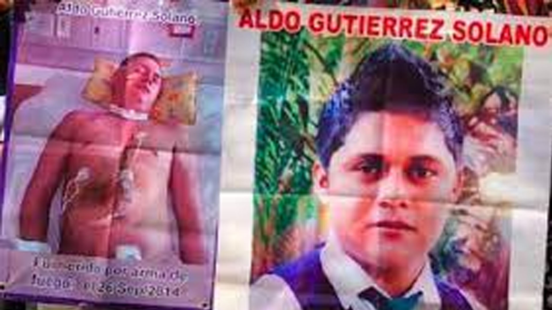 Ayotzinapa: En cama y con desfibrilador, las secuelas de Aldo tras  sobrevivir a un balazo en la cabeza