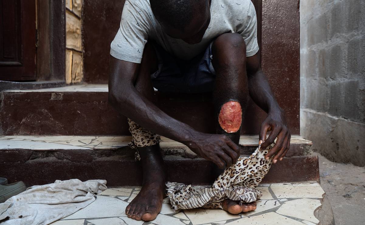 El "kush", la nueva droga que devasta a los jóvenes de África Occidental