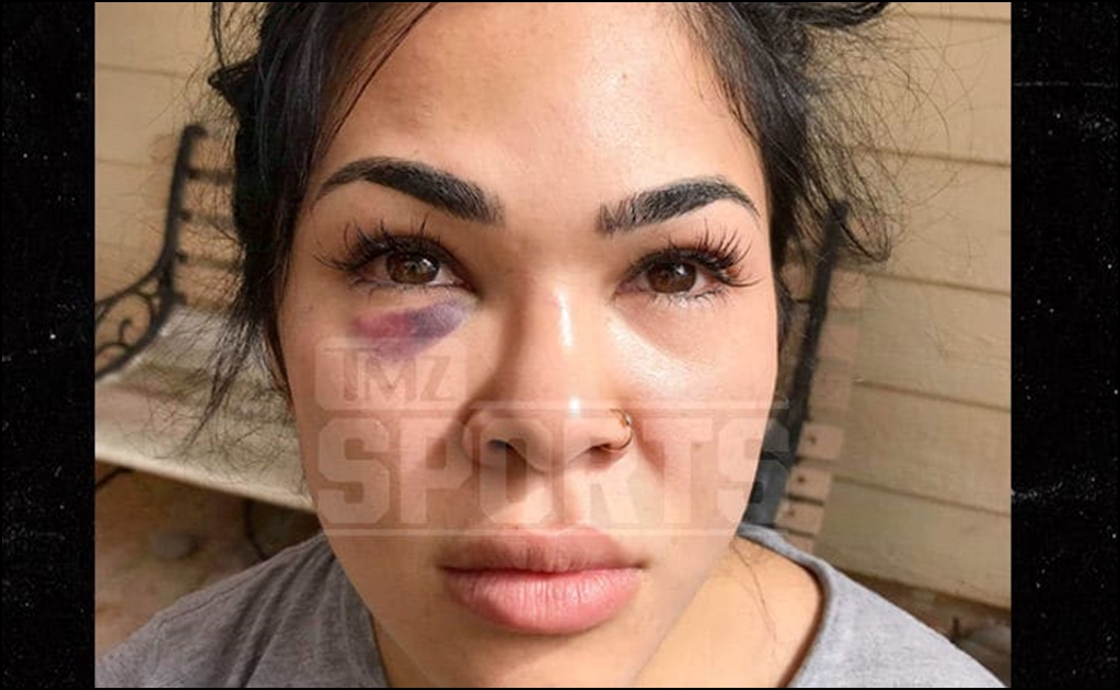 Peladora de UFC recibe golpiza de su esposo