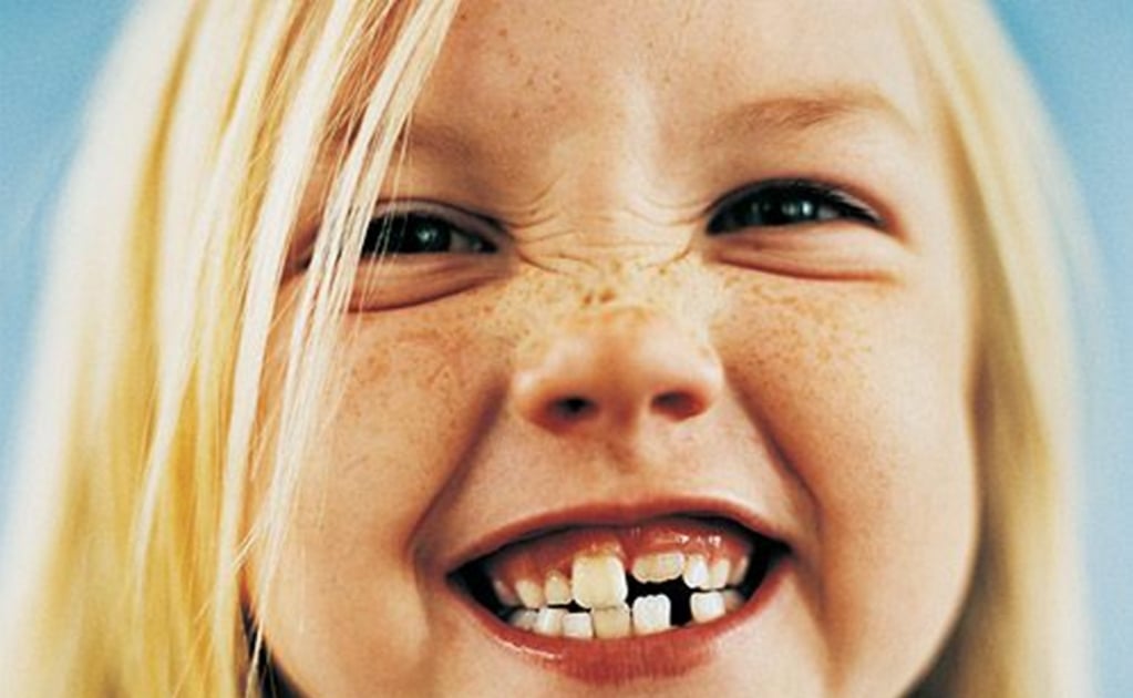 Caries en dientes de leche causa estragos en dentadura permanente
