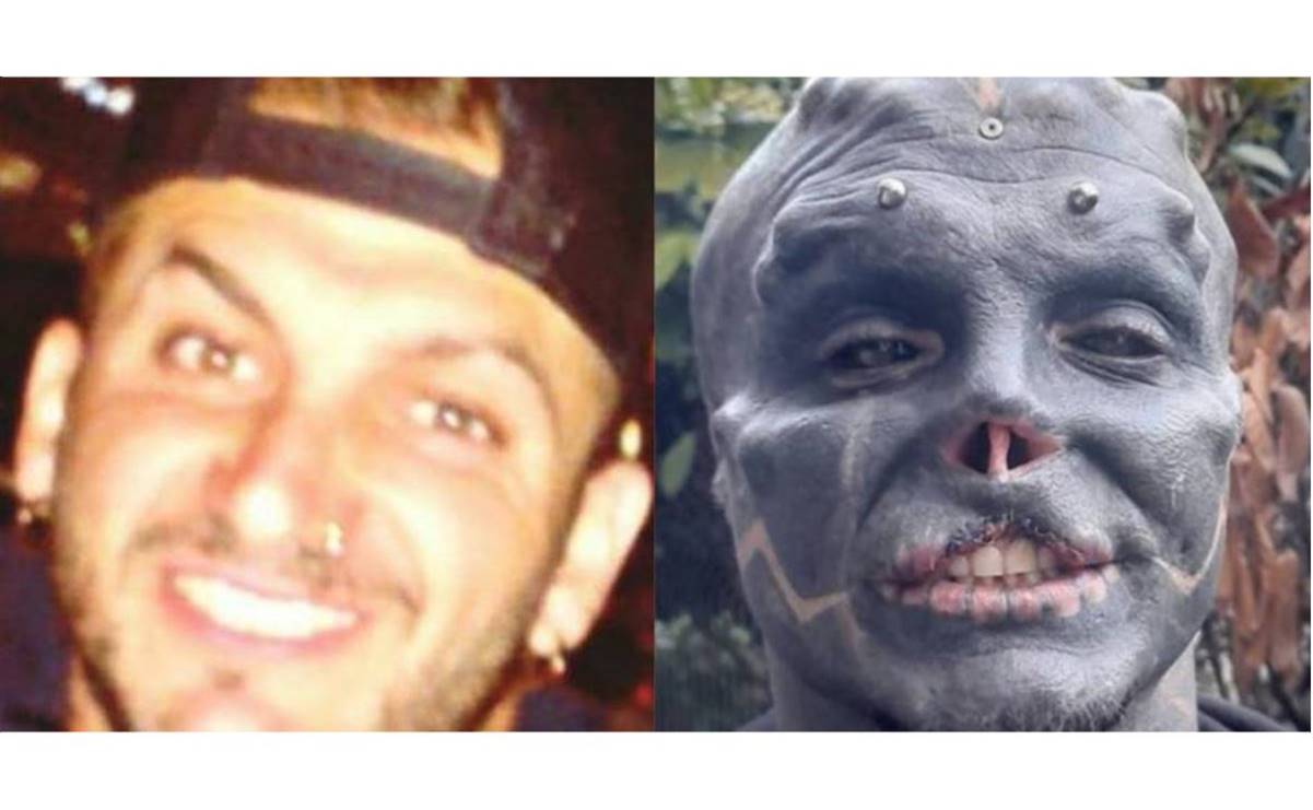 Hombre francés se quitó la nariz y un labio para verse como un extraterrestre