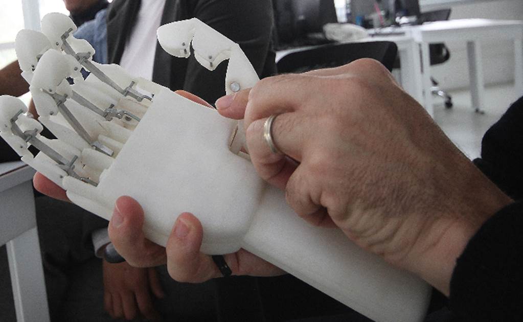 Niño francés recibe prótesis hecha con impresora 3D