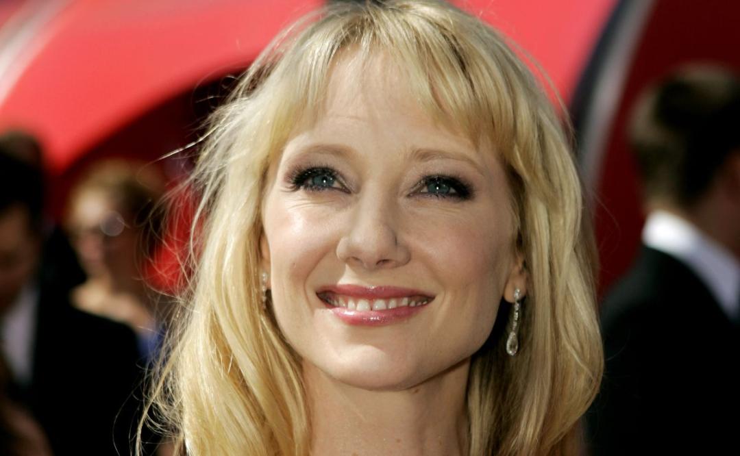 Anne Heche muere a los 53 años tras accidente automovilístico