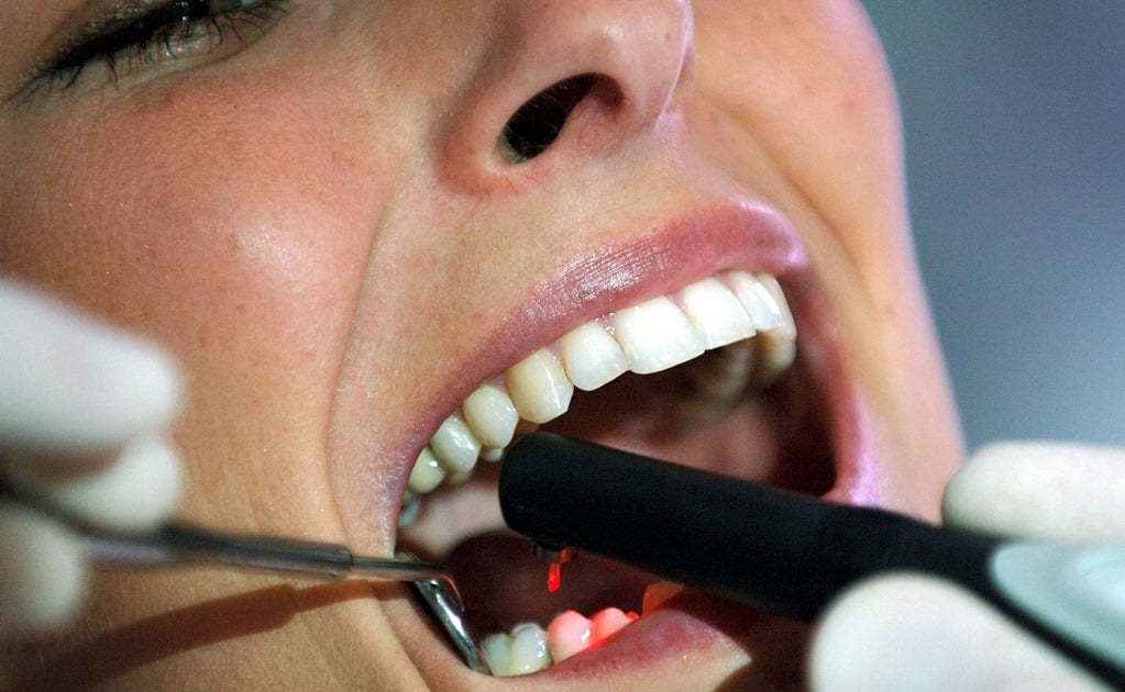 Desarrollan método para detectar microgrietas en dientes