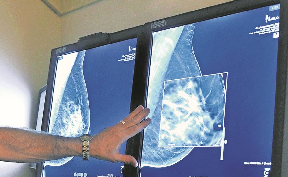 “Hay esperanza”: sobrevivientes del cáncer de mama