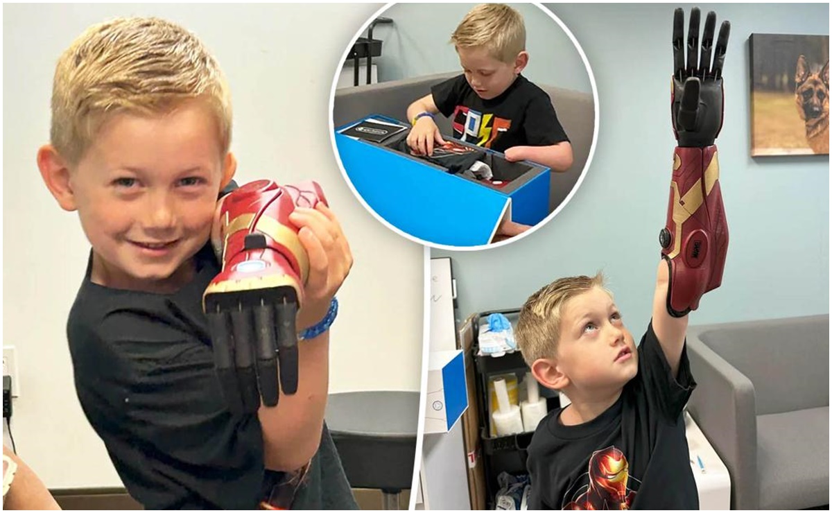 Al estilo Iron Man, niño de 5 años se convierte en el más joven del mundo en utilizar un brazo biónico