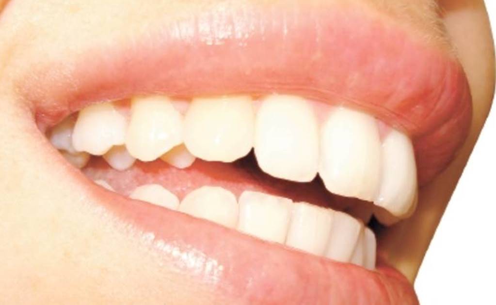 Desarrollan dientes en 3D que pueden combatir la placa bacteriana