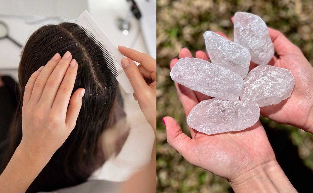 Cómo quitar la caspa del cabello con la piedra de alumbre