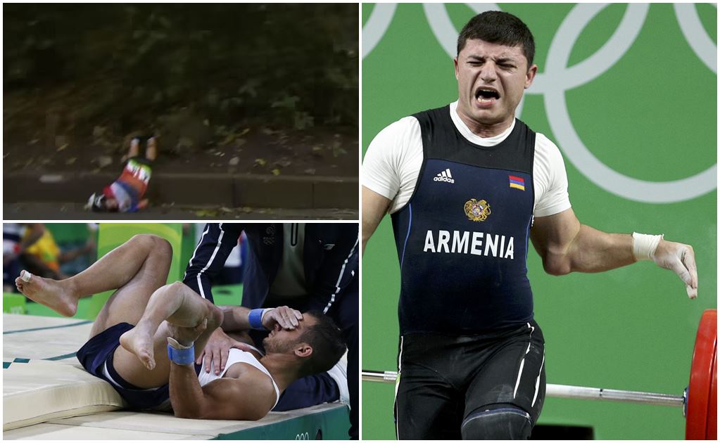 Las lesiones más dolorosas en Río 2016