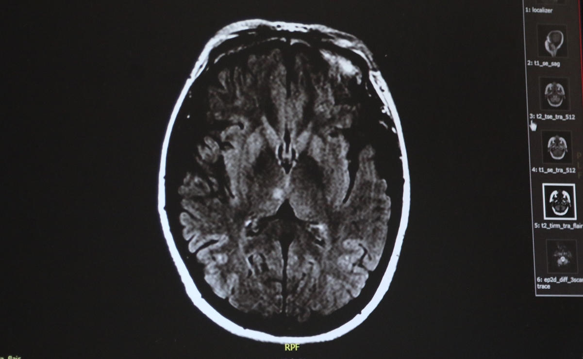 Ante felicidad o desagrado, neuronas modifican percepción del tiempo