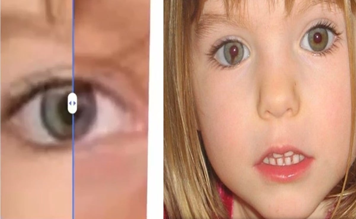 Madeleine McCann y la rara condición en el ojo que comparten la niña y la joven polaca