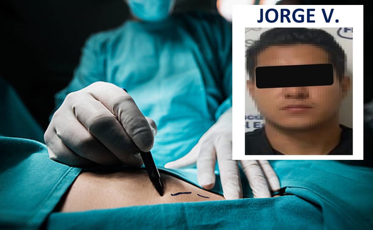 Dan 3 años de prisión a estudiante de medicina que realizó cirugía estética y mató a paciente en Jalisco