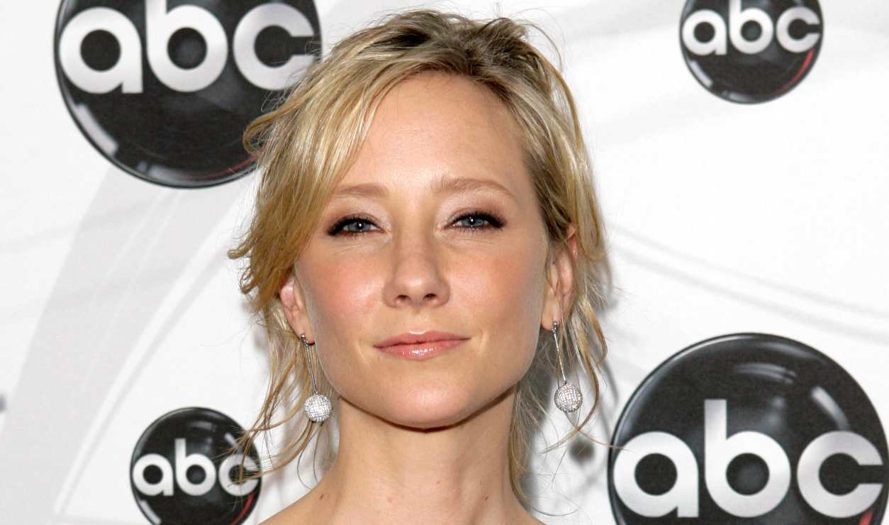 Anne Heche, en estado crítico tras chocar e incendiar su Mini Cooper