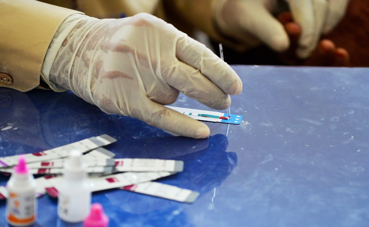 ¿Dónde hacerse la prueba de VIH gratis en CDMX?