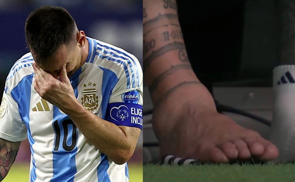 Cómo se encuentra la lesión en el tobillo de Lionel Messi