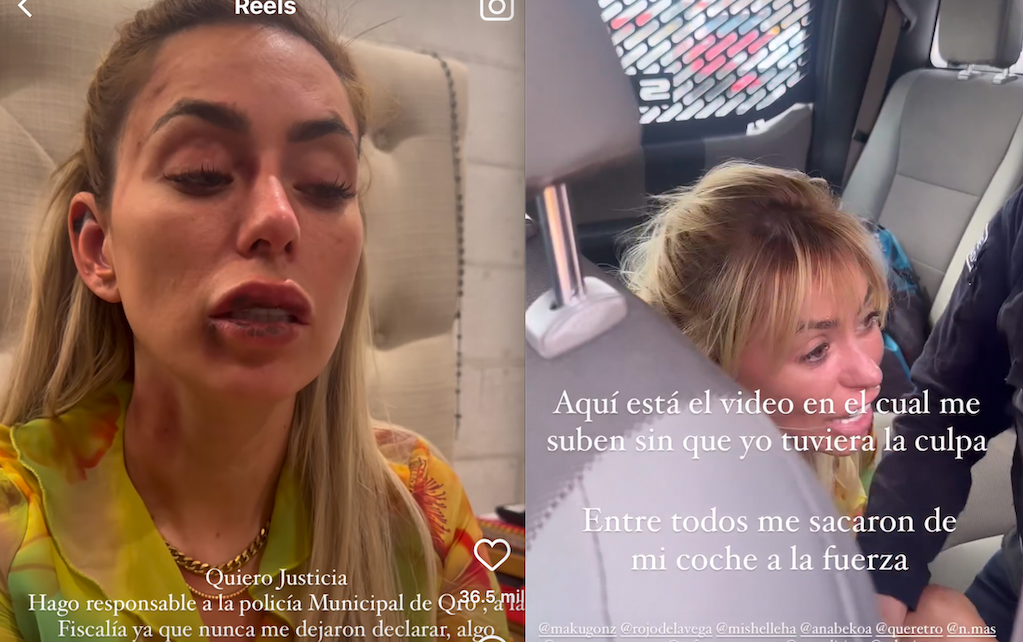 La influencer Florencia Alduncin denuncia haber sido golpeada por la policía de Querétaro