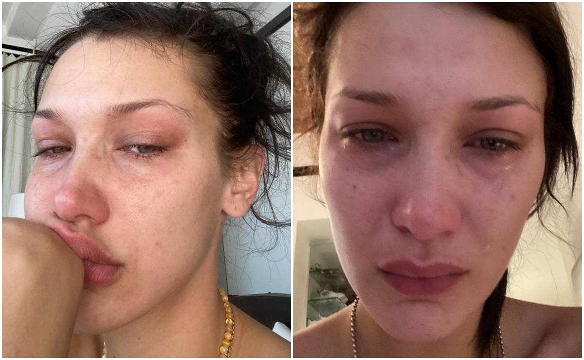 “Las redes sociales no son reales”, Bella Hadid padece depresión y ansiedad 