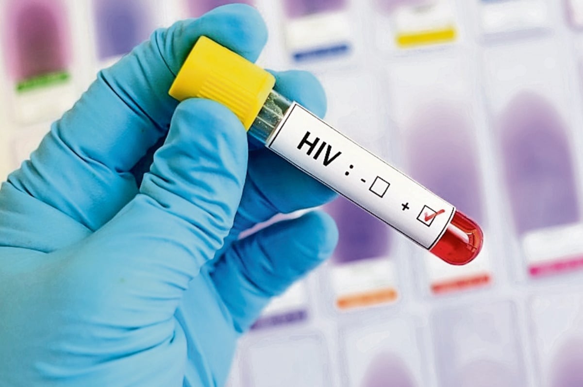 95% de personas con VIH han sido afectadas por el papiloma humano 