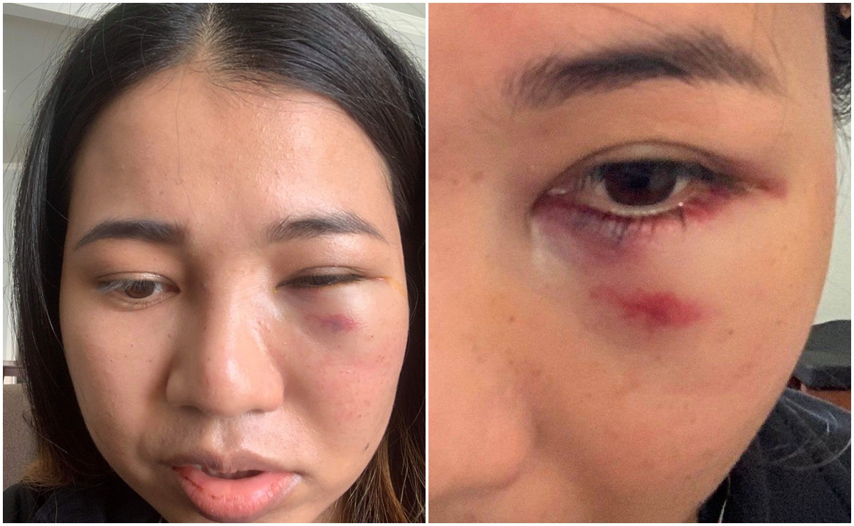 Mujer asiática es brutalmente golpeada en la cara en San Francisco