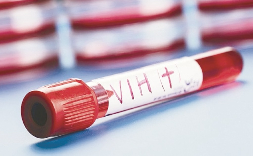 Yucatán, quinto lugar en número de casos de VIH: Censida