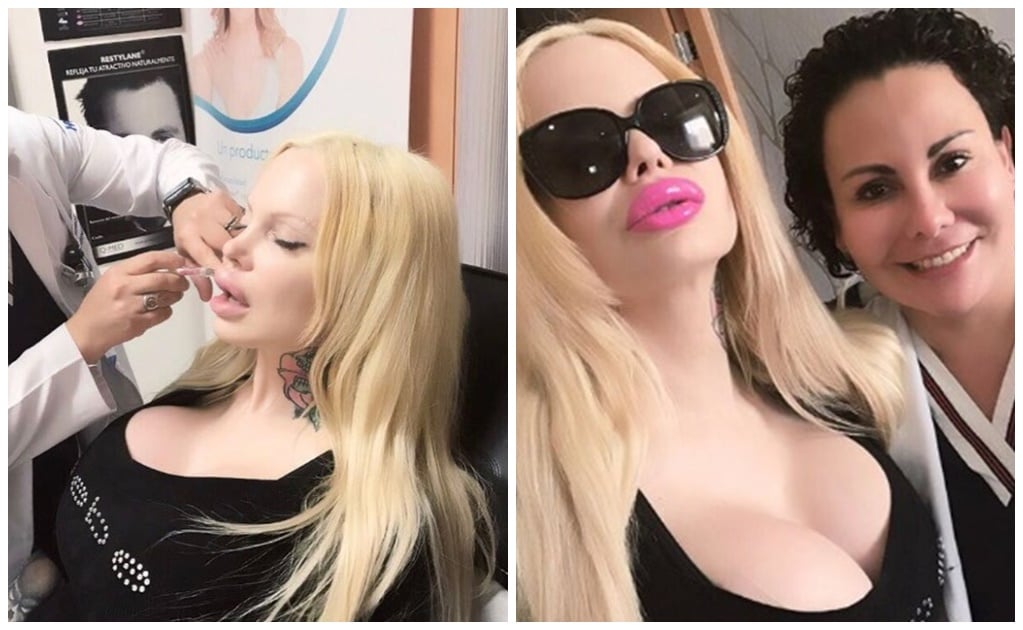 Sabrina Sabrok se inyecta los labios para películas porno