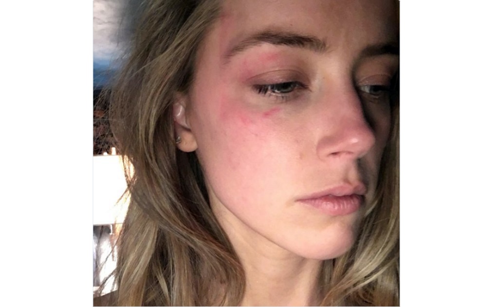 Amber Heard denuncia golpes de Johnny Depp 