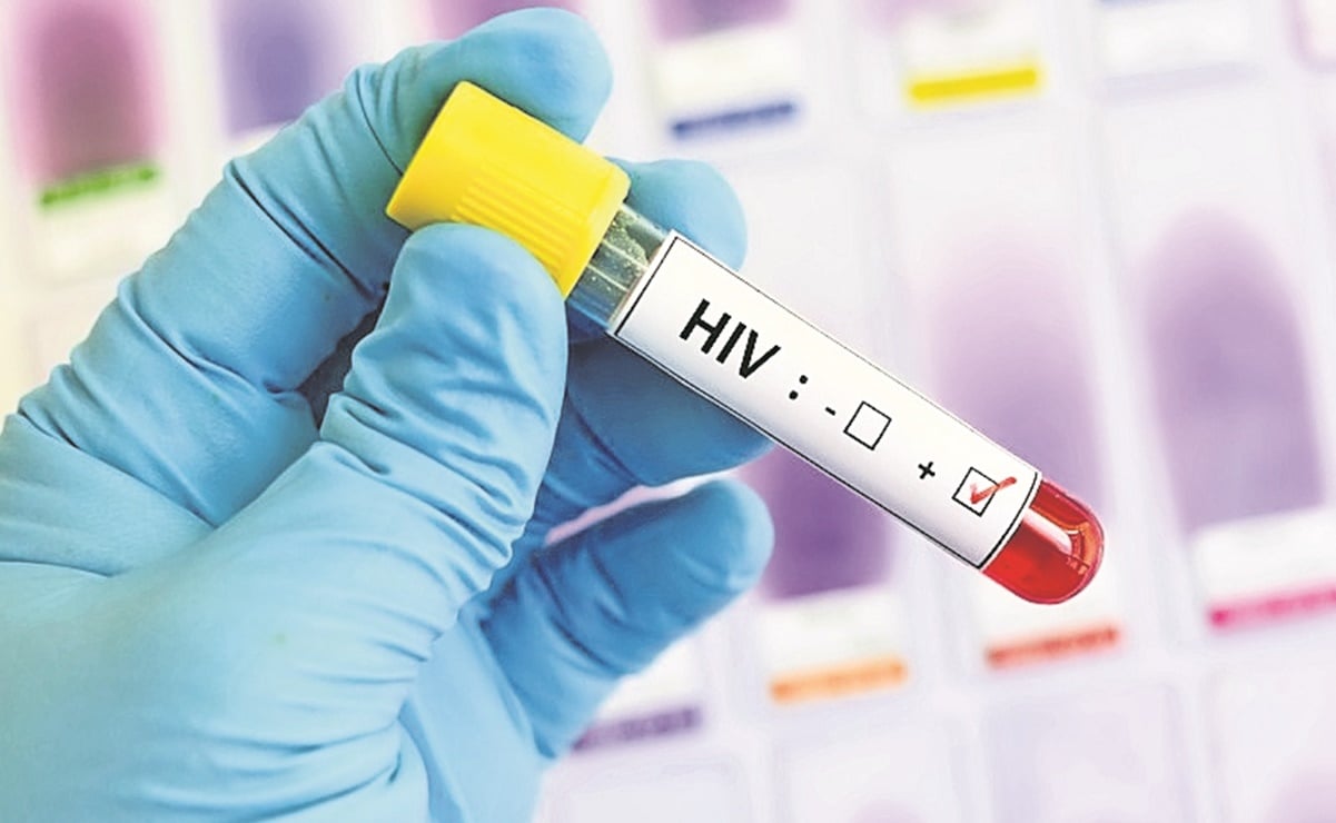 Prueban nueva vacuna contra el VIH; Covid dificulta estudios