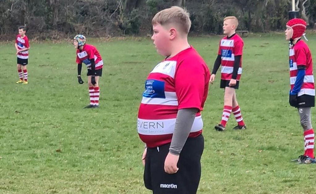 Campeones del rugby reaccionan ante la discriminación a un niño de 12 años: conmueven a las redes