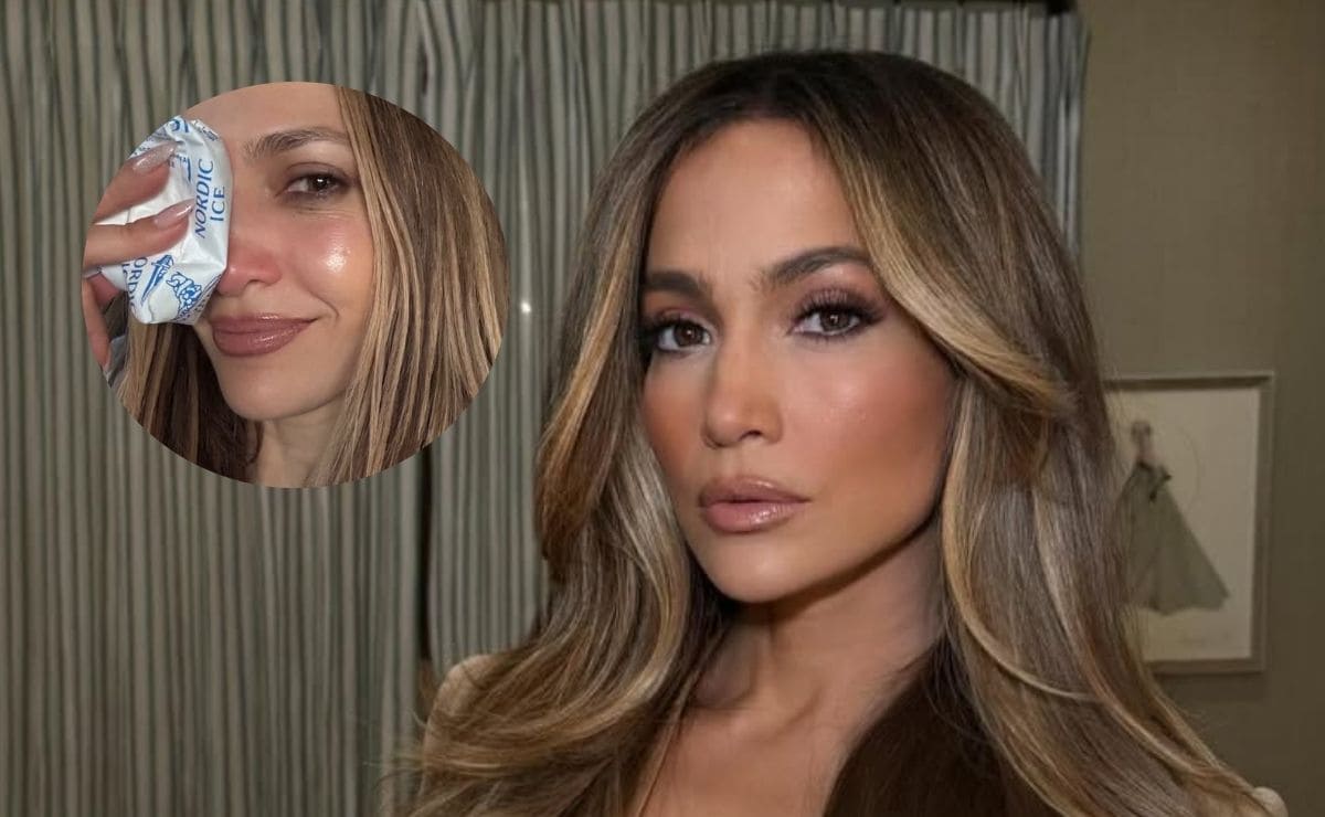 Fotos: Jennifer Lopez sufre doloroso accidente previo a los American Music Awards