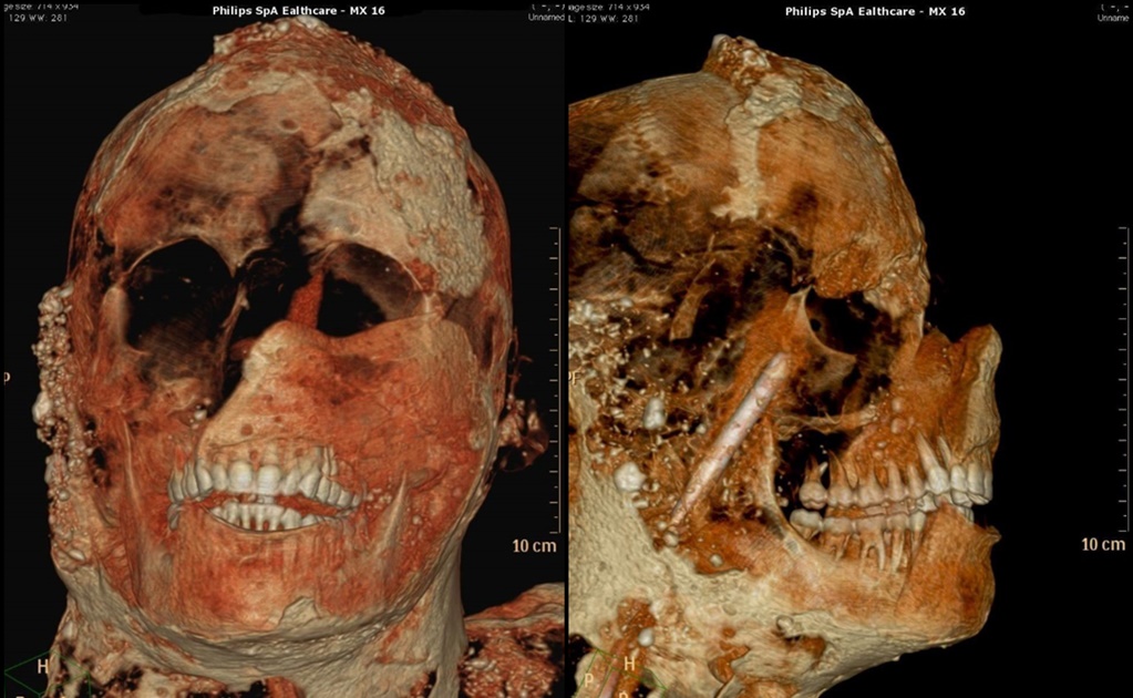 Habitantes de Pompeya tenían dentadura perfecta