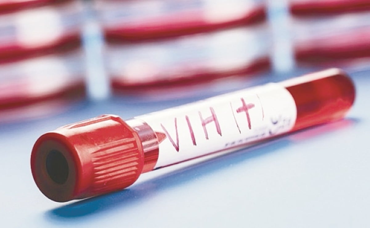 Van 3 mil 500 casos nuevos de VIH y sida en la CDMX