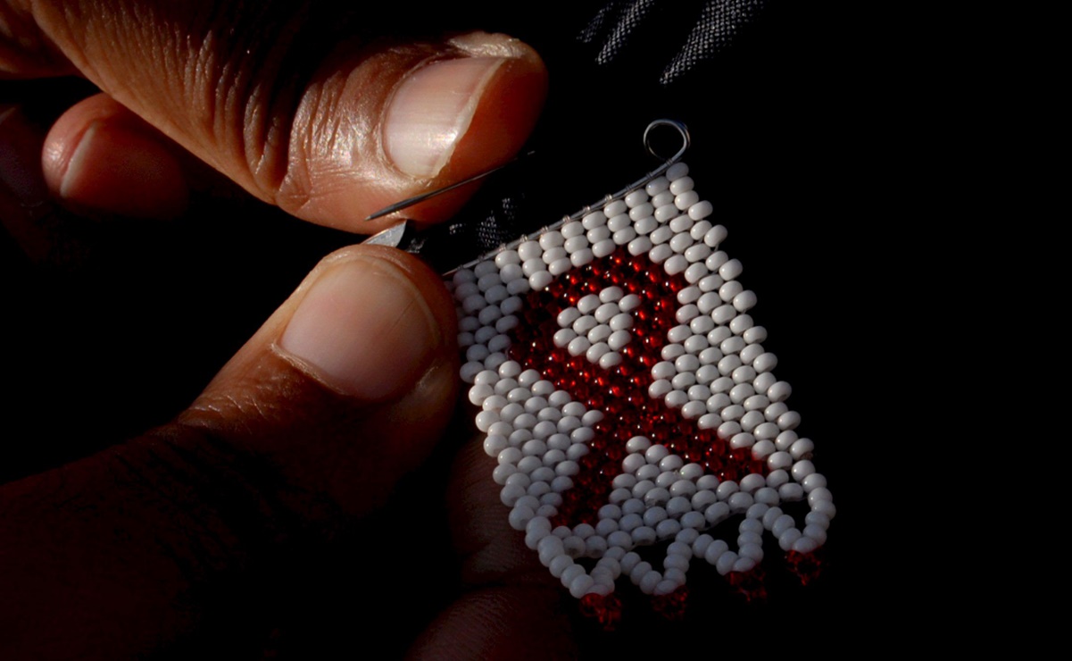Trasplantes en pacientes con VIH, podrían terminar con tratamientos antirretrovirales