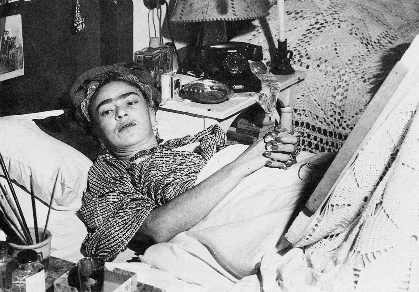 Frida Kahlo: The fatal accident that transformed her life and art