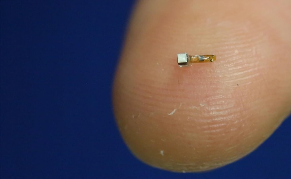 ¿Te implantarías un chip en el cerebro? Neuroprótesis que superan a la ciencia ficción