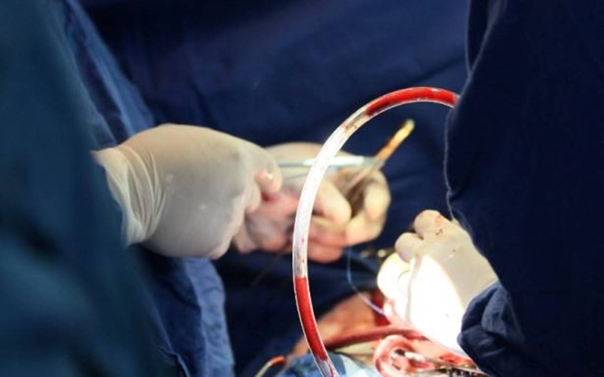 Realizan con éxito el treceavo trasplante de corazón en el Hospital General de La Raza