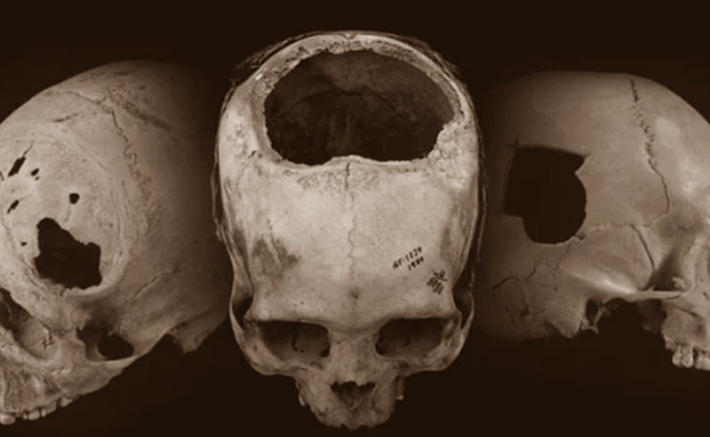 La civilización prehispánica inca, experta en perforar cráneos