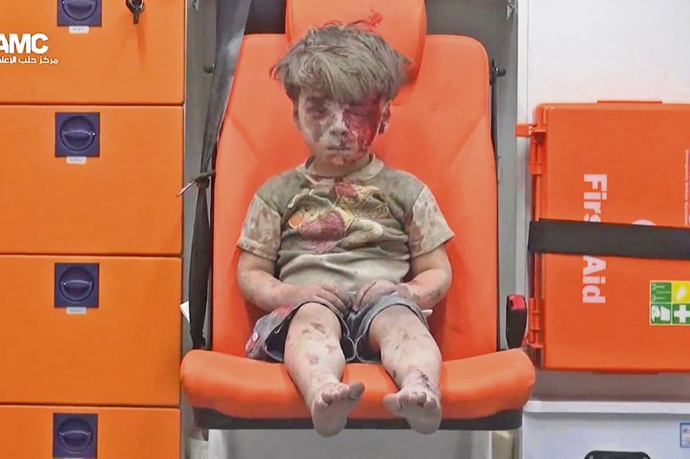Un niño pone rostro a la tragedia en Alepo