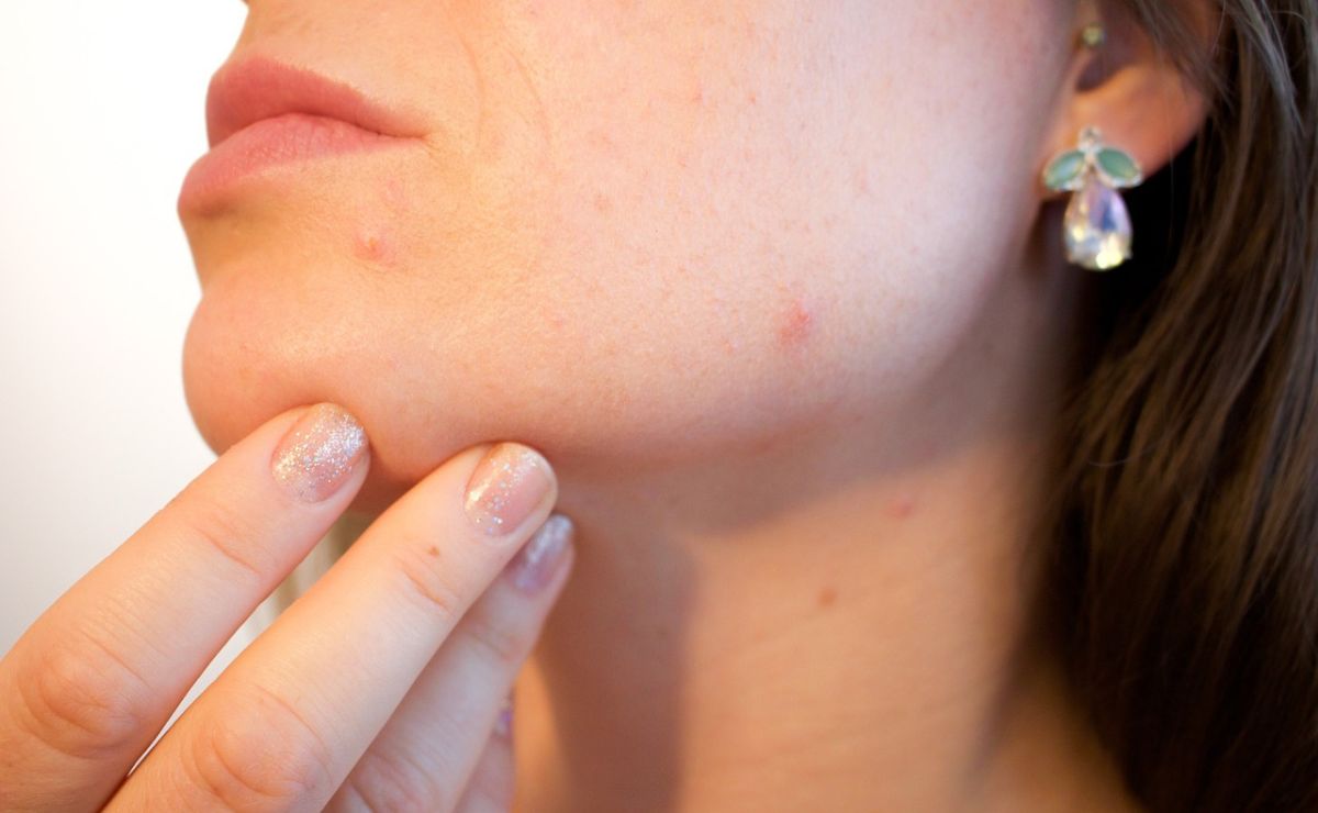 3 enfermedades que puedes detectar a tiempo porque se manifiestan primero en la piel