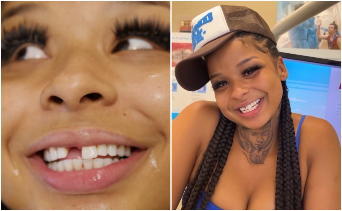 La influencer Chrisean Rock se tatúa el rostro de su ex novio ¡en un diente!