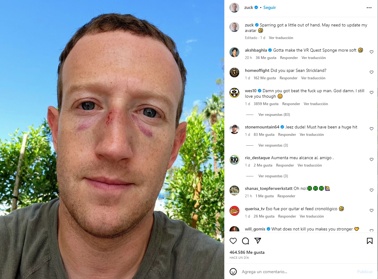 Mark Zuckerberg aparece con moretones en la cara: "el combate se salió un poco de control"