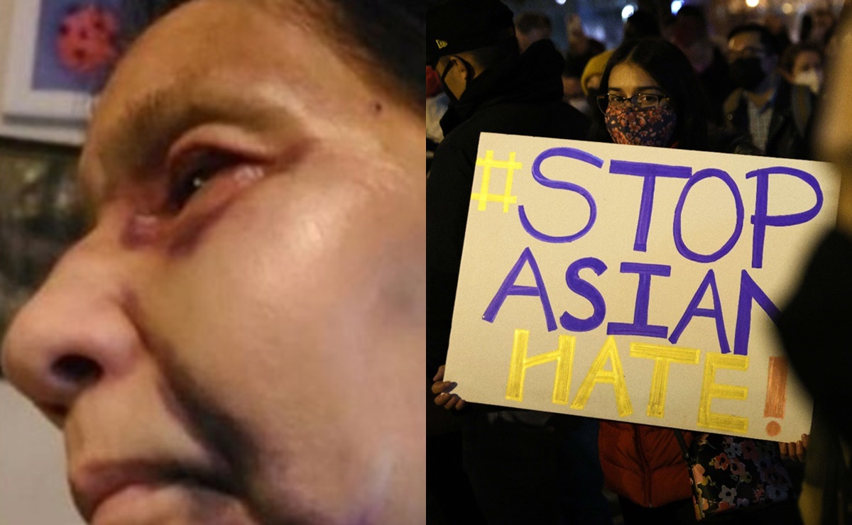 Golpean a mujer de origen mexicano en LA tras confundirla con asiática