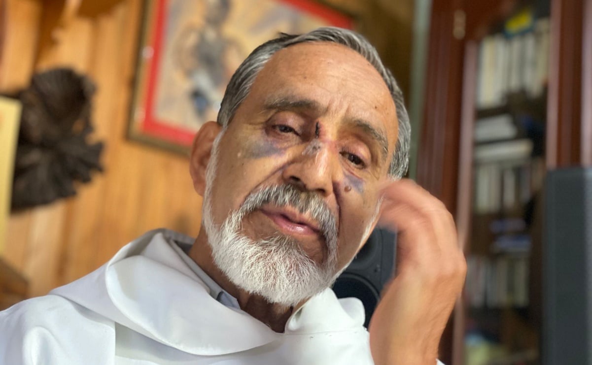 Me salió barato, pudo costarme la vida, dice sacerdote de Michoacán golpeado